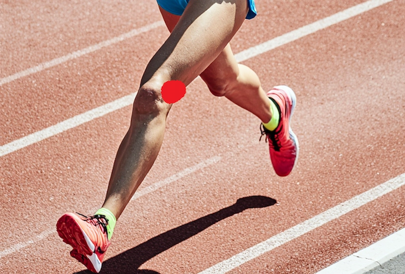 Syndrome de la bandelette ilio-tibiale (essuie-glace) physio sport training